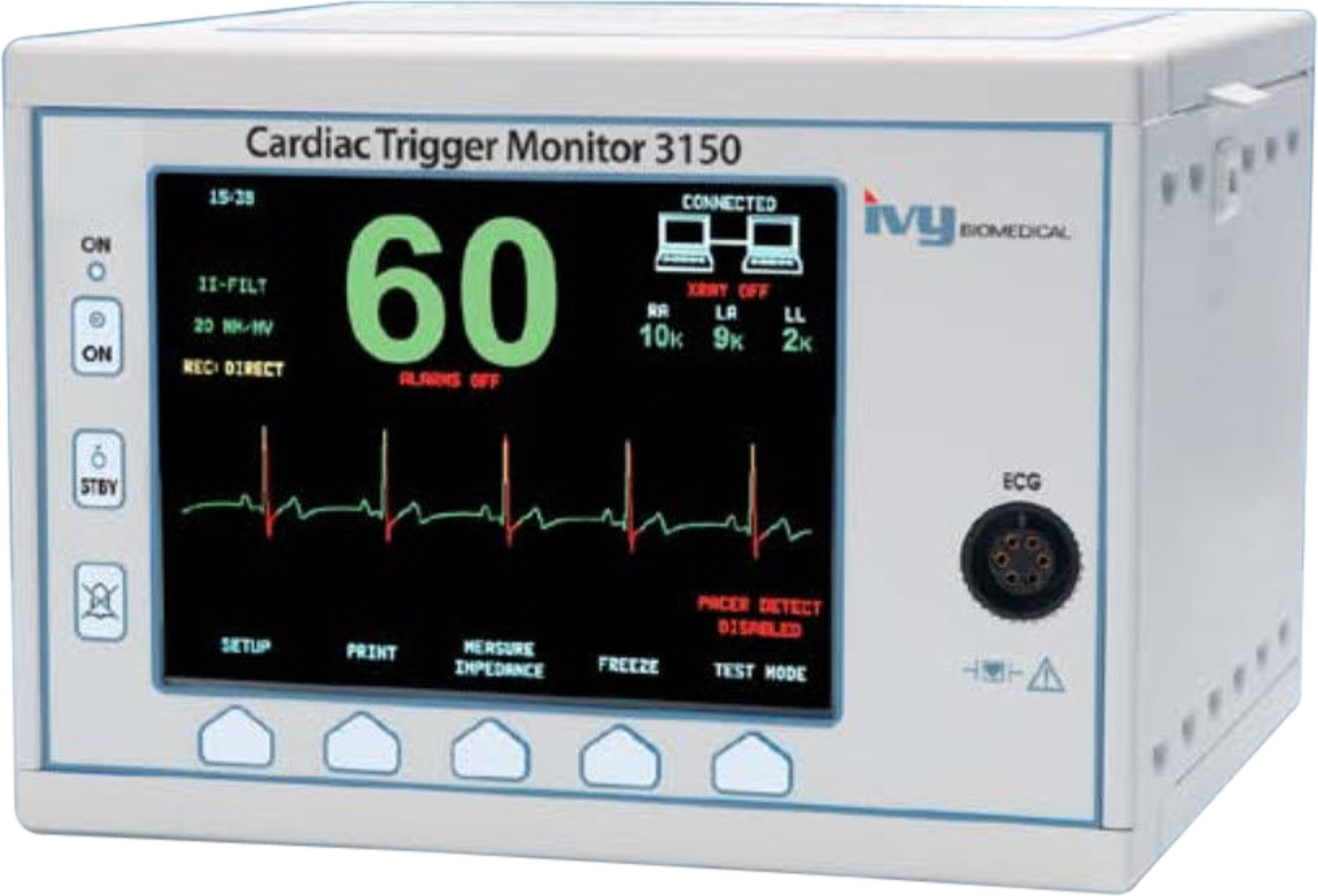 ECG IVY - Upservice Tecnologia